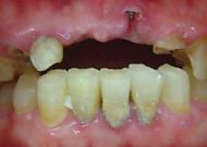 一般歯科/歯周病治療